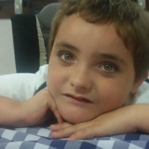 Sindrome angelman Yago - Puro Omega