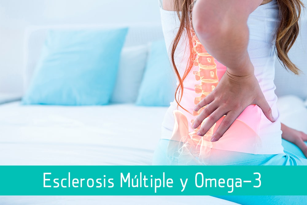 Un estudio vincula el consumo ácidos grasos omega-3 con menor riesgo de padecer esclerosis múltiple