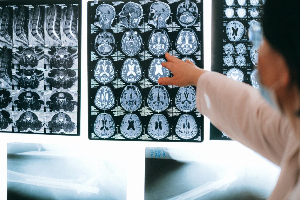 Cómo el omega 3 Ayuda a Desinflamar el Vientre (Eje intestino-cerebro)