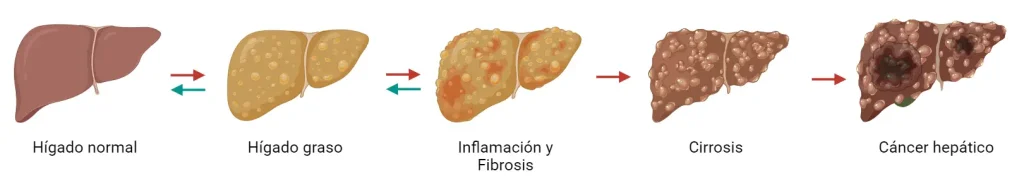 omega 3 e higado graso